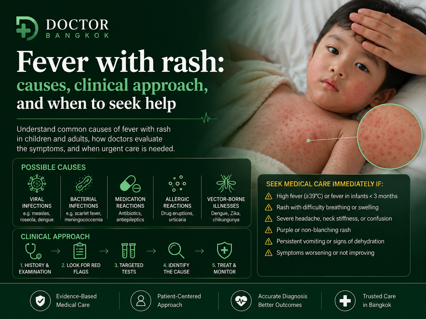 fever with rash